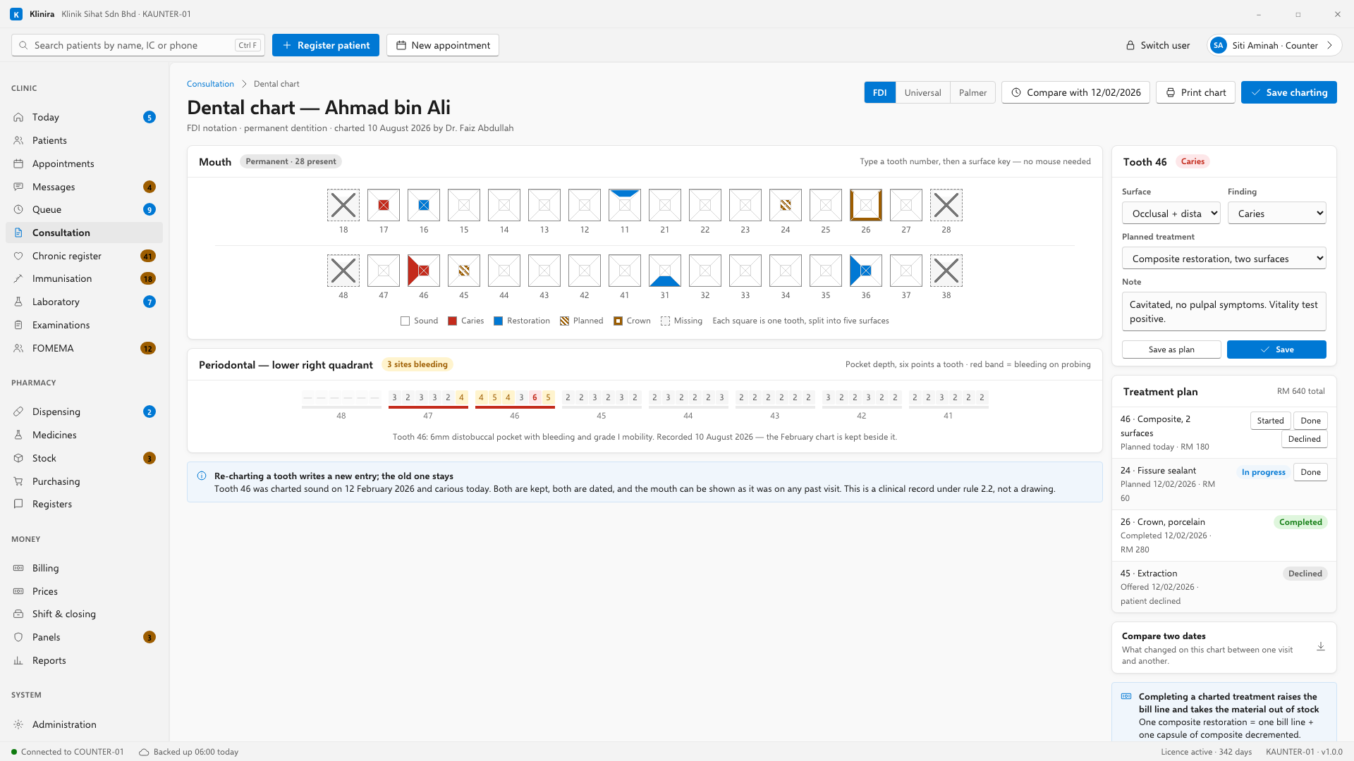 The dental chart. FDI two-digit numbering, five surfaces a tooth. Charting is keyboard-first: tooth number, surface, finding.